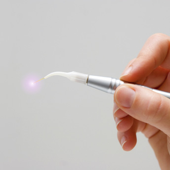 Laser Dentistry Minimally Invasive